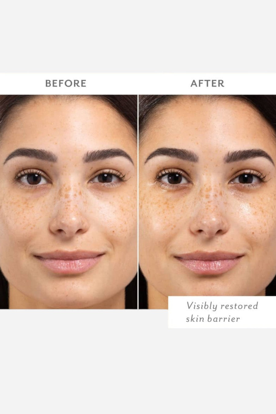 Patchology Skin Remedy Barrier-Boosting Sheet Mask - Single – side view