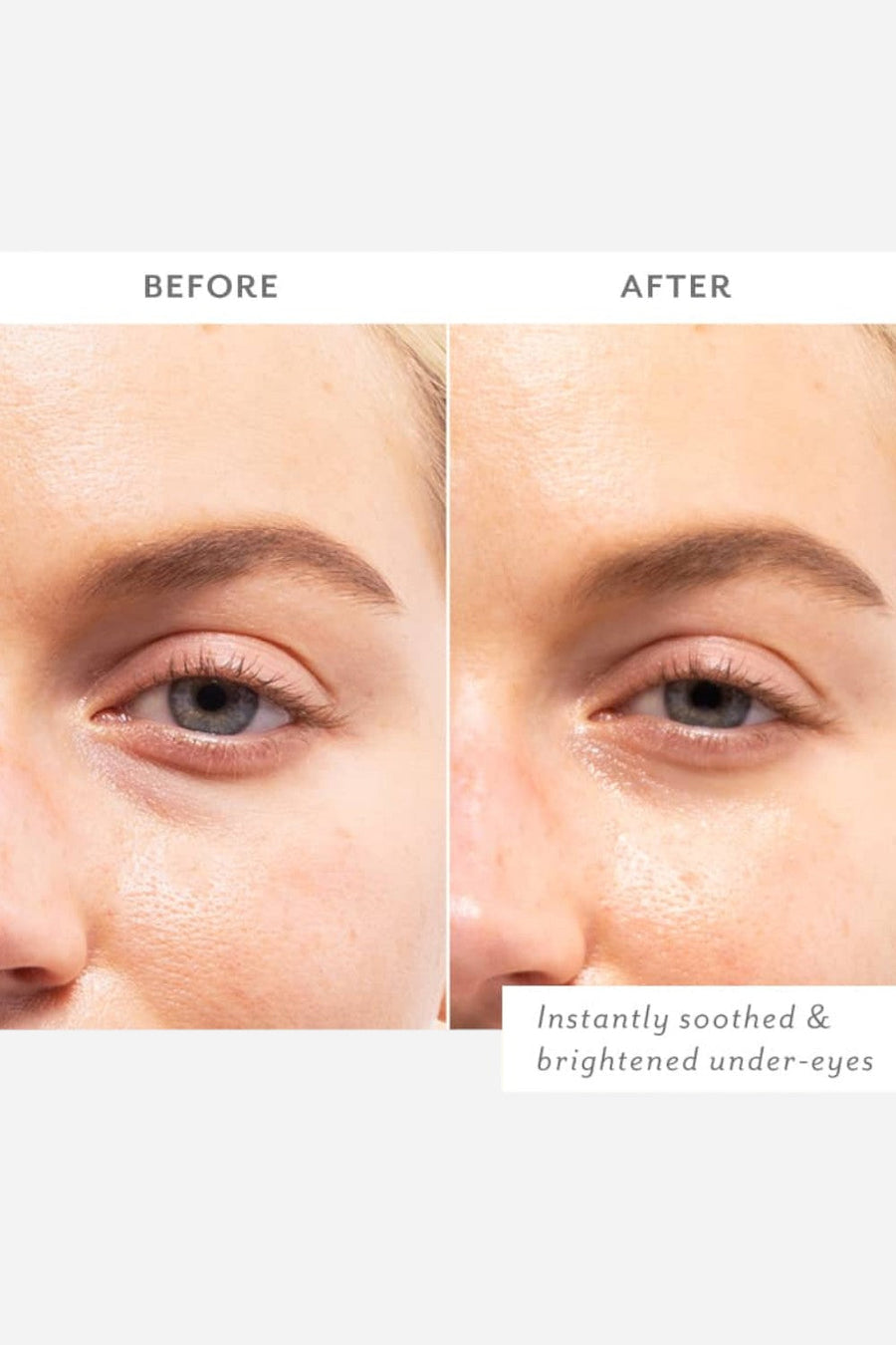 Patchology Skin Remedy Soothing Eye Gels - Single – detail